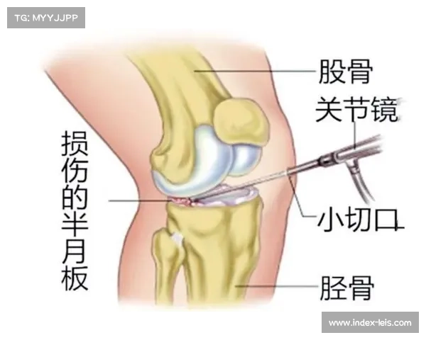 加维恢复有球训练迎关键里程碑,五个月半月板手术后复出在即 加维恢复有球训练迎关键里程碑,五个月半月板手术后复出在即